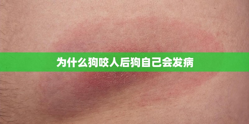 为什么狗咬人后狗自己会发病 为什么狗咬人后狗自己会发病