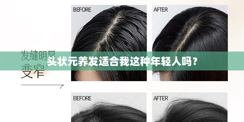 头状元养发适合我这种年轻人吗？