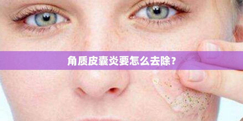 角质皮囊炎要怎么去除？