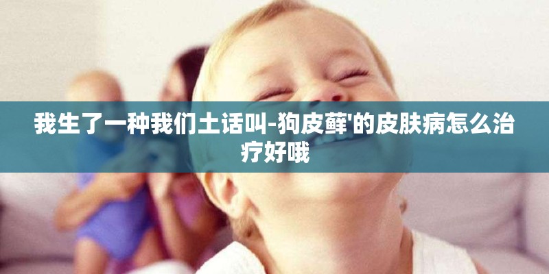 我生了一种我们土话叫-狗皮藓'的皮肤病怎么治疗好哦