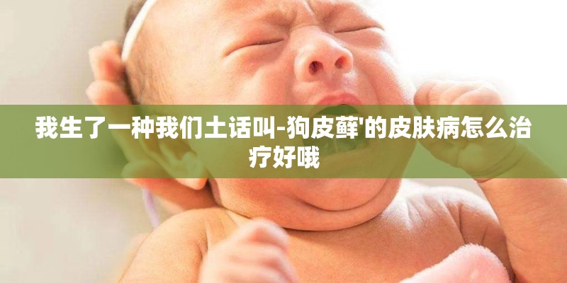 我生了一种我们土话叫-狗皮藓'的皮肤病怎么治疗好哦