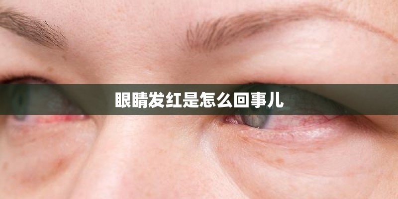 眼睛发红是怎么回事儿