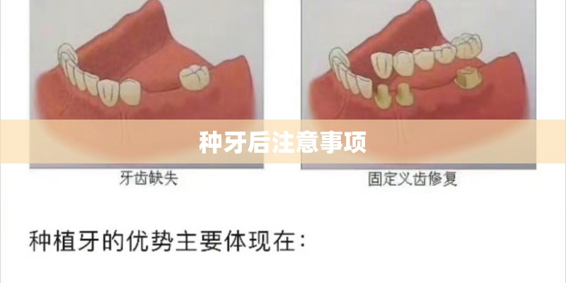 种牙后注意事项