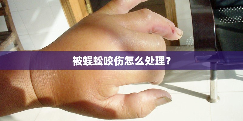被蜈蚣咬伤怎么处理？