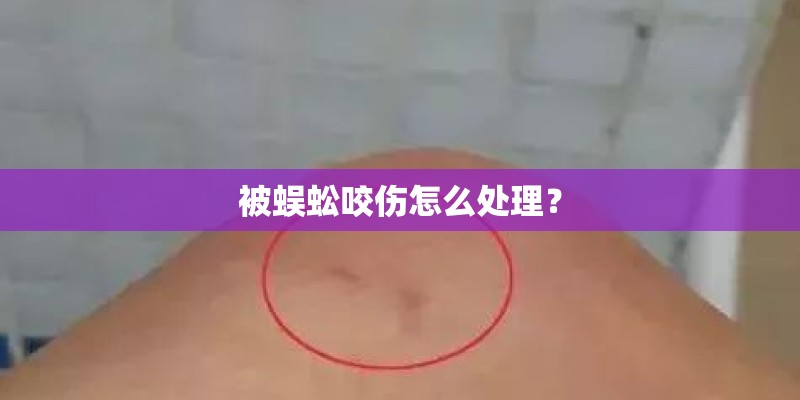 被蜈蚣咬伤怎么处理？
