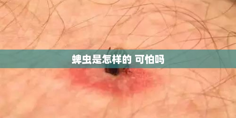 蜱虫是怎样的 可怕吗
